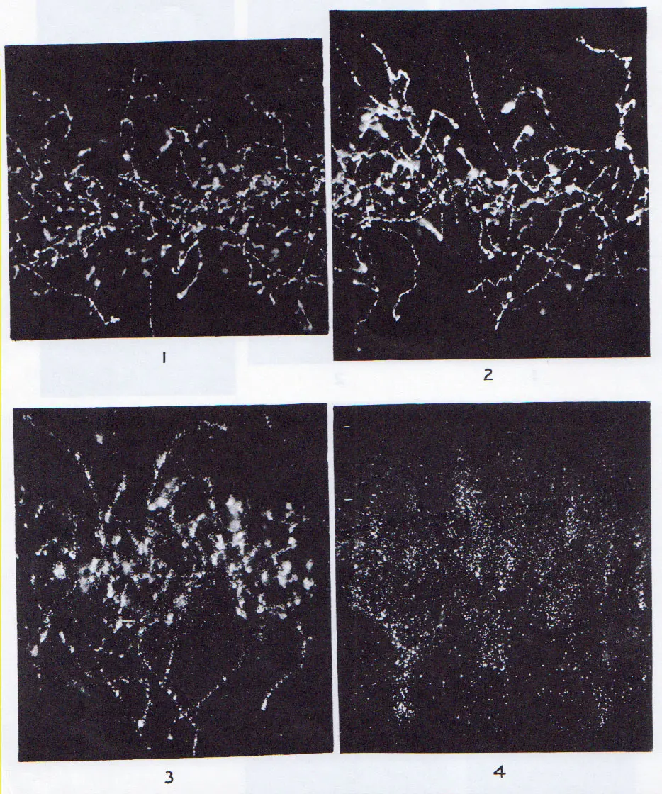 Four black-and-white photographs, each a dark square crossed by many thin, curling white threads of tiny dots