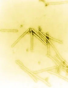 Tobacco mosaic virus particles, thin rods magnified 160,000 times